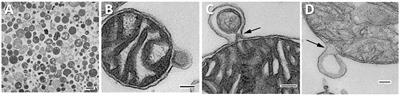 Mitochondrial extracellular vesicles, autoimmunity and myocarditis